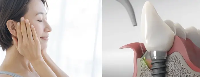 女性とfotonaレーザー機器の写真