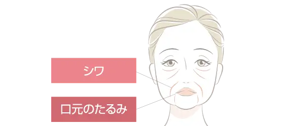 たるみ・シワの図解イラスト
